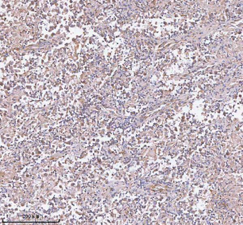 Anti-hIST1/IST1 Antibody