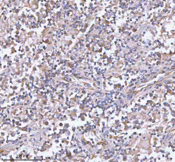 Anti-hIST1/IST1 Antibody