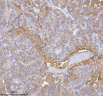 Anti-hIST1/IST1 Antibody