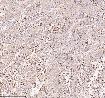 Anti-IRS4 Antibody