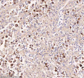 Anti-IRS4 Antibody