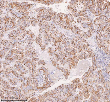 Anti-IRS4 Antibody