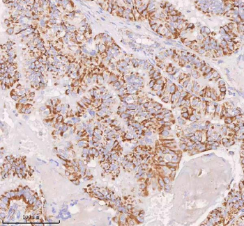 Anti-IRS4 Antibody