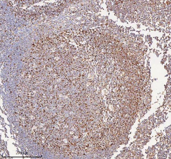 Anti-IRS4 Antibody