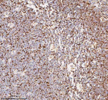 Anti-IRS4 Antibody