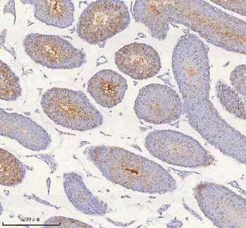 Anti-IRS4 Antibody