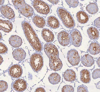 Anti-IRS4 Antibody