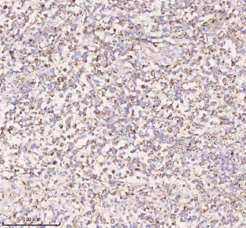 Anti-IRS4 Antibody