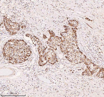 Anti-IRS4 Antibody