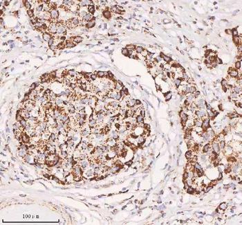 Anti-IRS4 Antibody
