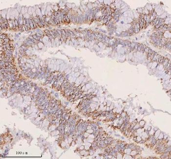 Anti-IRS4 Antibody