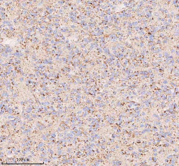 Anti-IRS4 Antibody