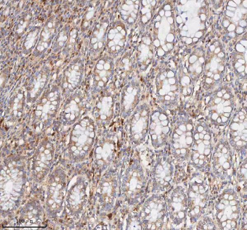 Anti-CD127/IL7R Antibody