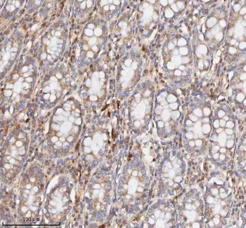 Anti-CD127/IL7R Antibody