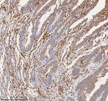 Anti-CD127/IL7R Antibody