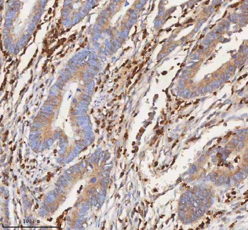 Anti-CD127/IL7R Antibody