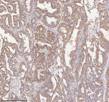 Anti-HSPA1L Antibody