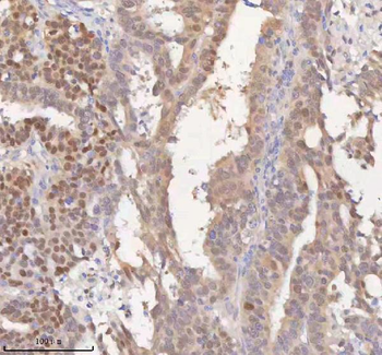 Anti-HSPA1L Antibody