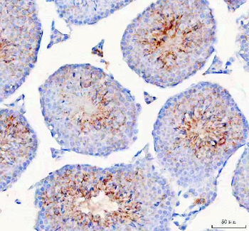 Anti-HSPA1L Antibody