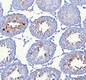 Anti-HSPA1L Antibody