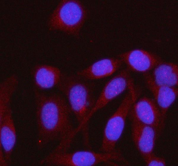 Anti-HENMT1 Antibody