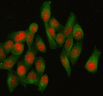 Anti-HELLS Antibody
