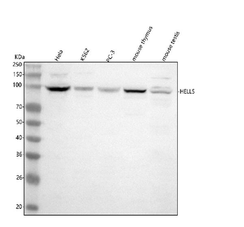 Anti-HELLS Antibody