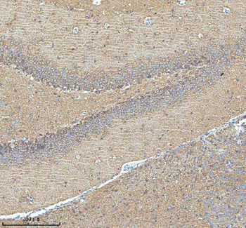 Anti-HDHD5 Antibody