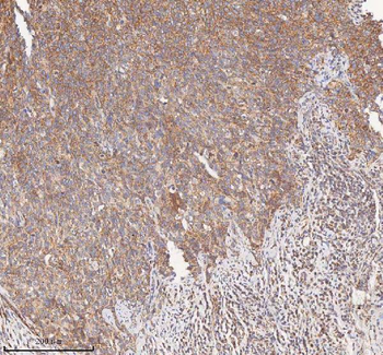 Anti-HDHD5 Antibody