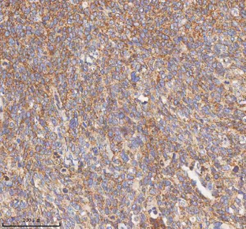 Anti-HDHD5 Antibody