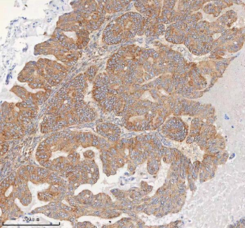 Anti-HDHD5 Antibody