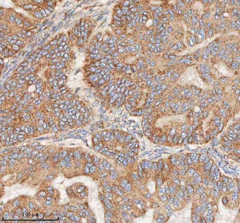 Anti-HDHD5 Antibody