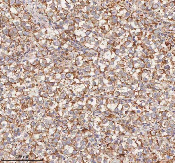 Anti-HDHD5 Antibody