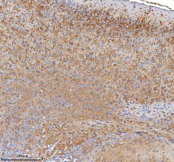 Anti-HDHD5 Antibody