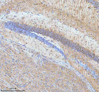 Anti-HDHD5 Antibody