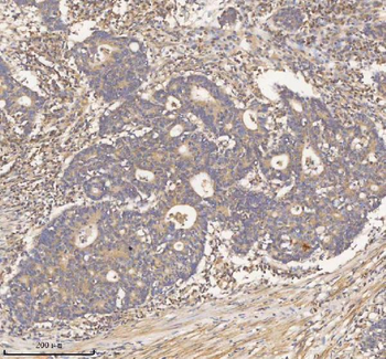 Anti-HDHD2 Antibody