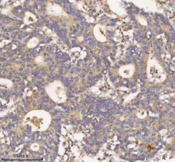 Anti-HDHD2 Antibody