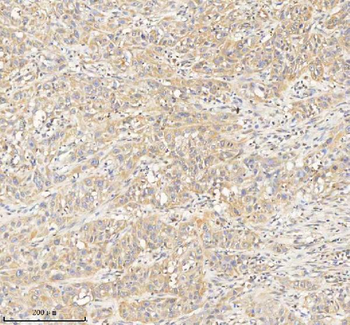 Anti-HDHD2 Antibody