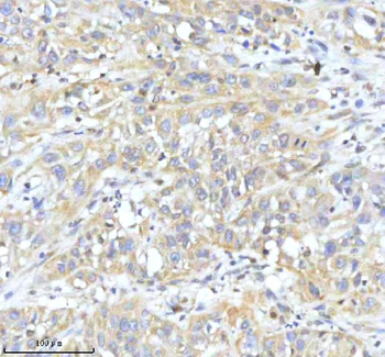 Anti-HDHD2 Antibody