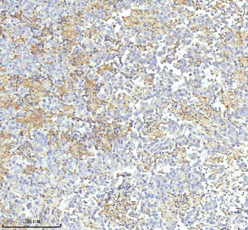 Anti-HDHD2 Antibody