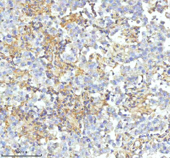 Anti-HDHD2 Antibody