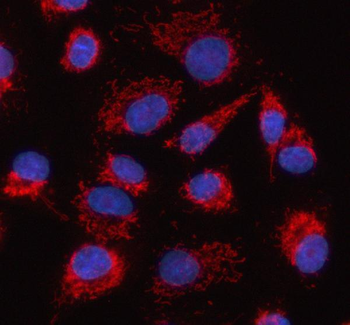 Anti-HDGFL2 Antibody