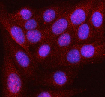 Anti-HDDC2 Antibody