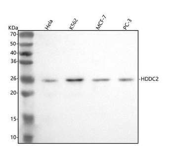 Anti-HDDC2 Antibody