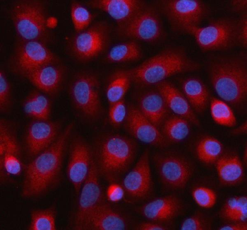 Anti-UCHL5IP/HAUS7 Antibody