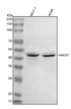 Anti-UCHL5IP/HAUS7 Antibody