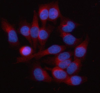 Anti-HAUS3 Antibody