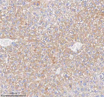 Anti-HAO1 Antibody