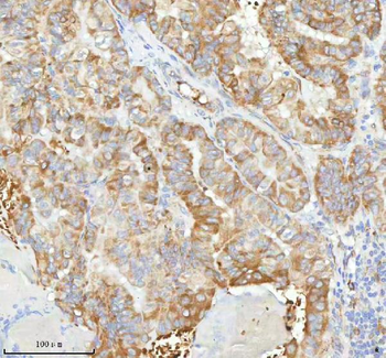Anti-HAGH Antibody