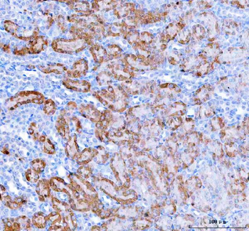 Anti-HAGH Antibody